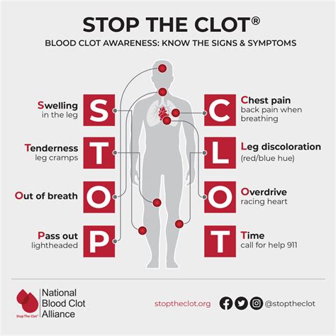 Alert: Don't Ignore the Warning Signs of a Blood Clot in the Arm